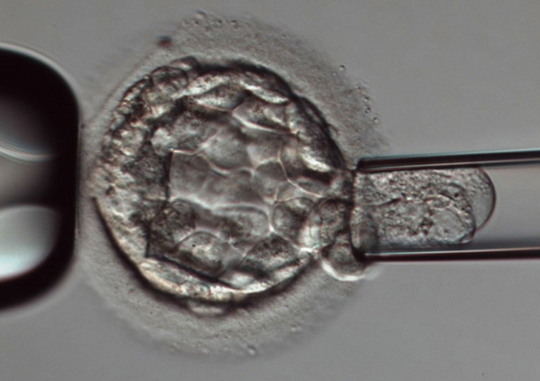 Pre-implantation Genetic Testing